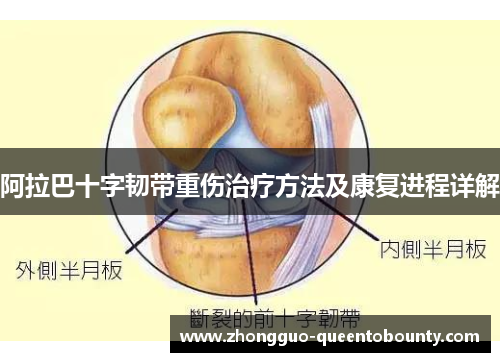 阿拉巴十字韧带重伤治疗方法及康复进程详解 阿拉巴十字韧带重伤治疗方法及康复进程详解